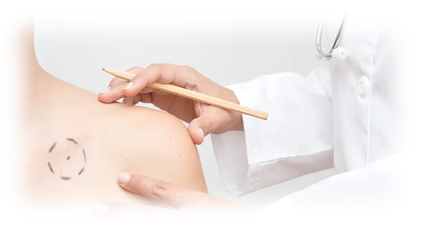 Skin Excisions